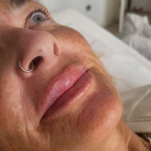 509601036_122100793196912796_1849486698161800941_n